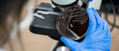 Scientist holding agar plate for diagnosis bacterial ormic