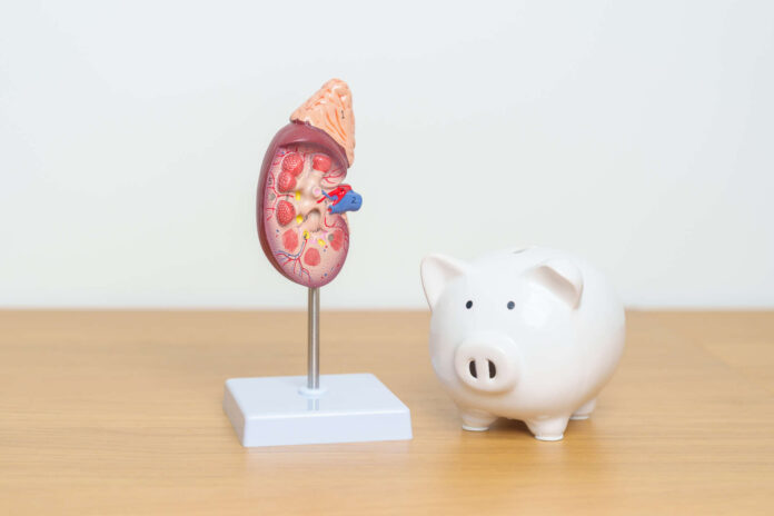 Anatomical human kidney Adrenal gland model with Piggy Bank